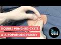 Double Punched Cysts and a Family of Popaholics
