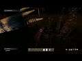 Dayz - Fresh Start Girly - pt15  Microbial infection from fight needs curing + Nite Wolf Attack