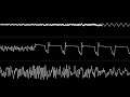 LMan - "Rastaline Dub" (C64) [Oscilloscope View]