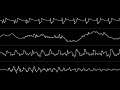 Tip & Mantronix - “Act of Impulse” (Amiga MOD) [Oscilloscope View]
