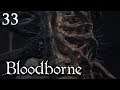 Zagrajmy w Bloodborne [#33] - AMYGDALA