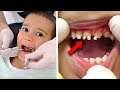 6 Year Old Boy Couldn't Speak A Word, Then His Dentist Makes A Startling Discovery